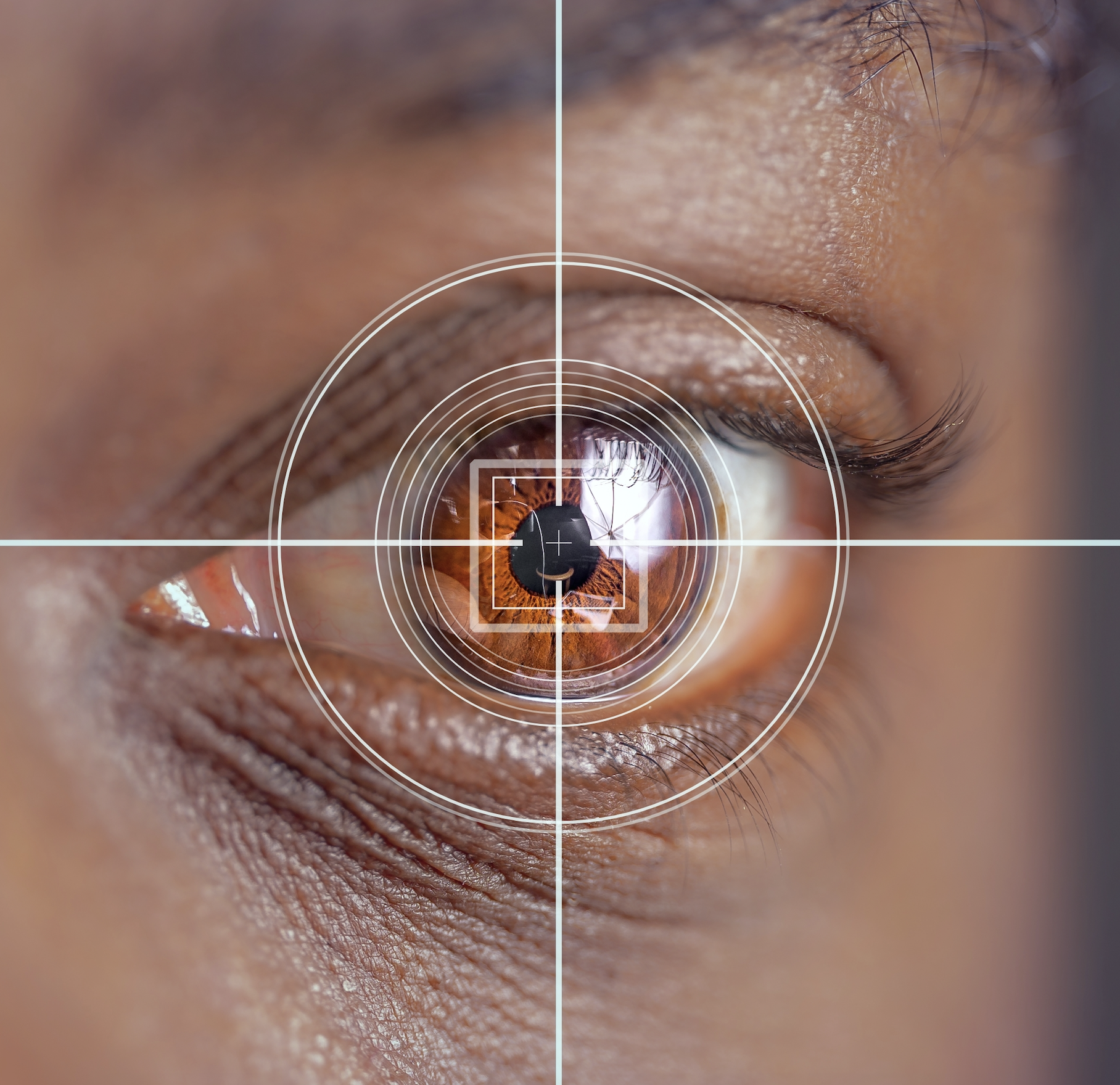 Homewood eye doctors providing cataract retina glaucoma cornea and laser eye care services