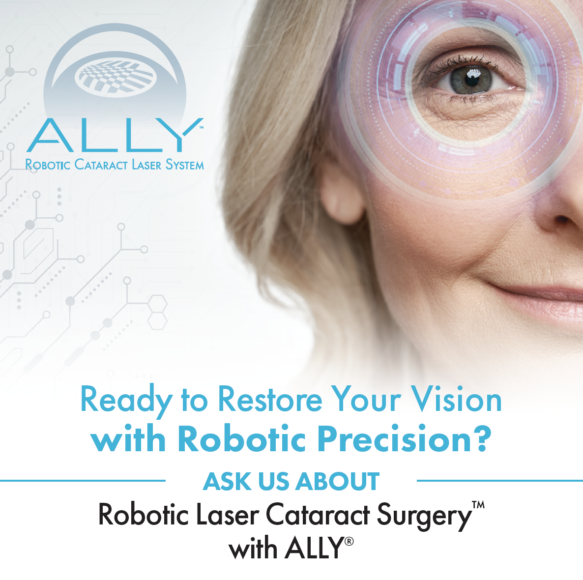 ALLY LENSAR SouthEast Eye Specialists Chattanooga TN-1