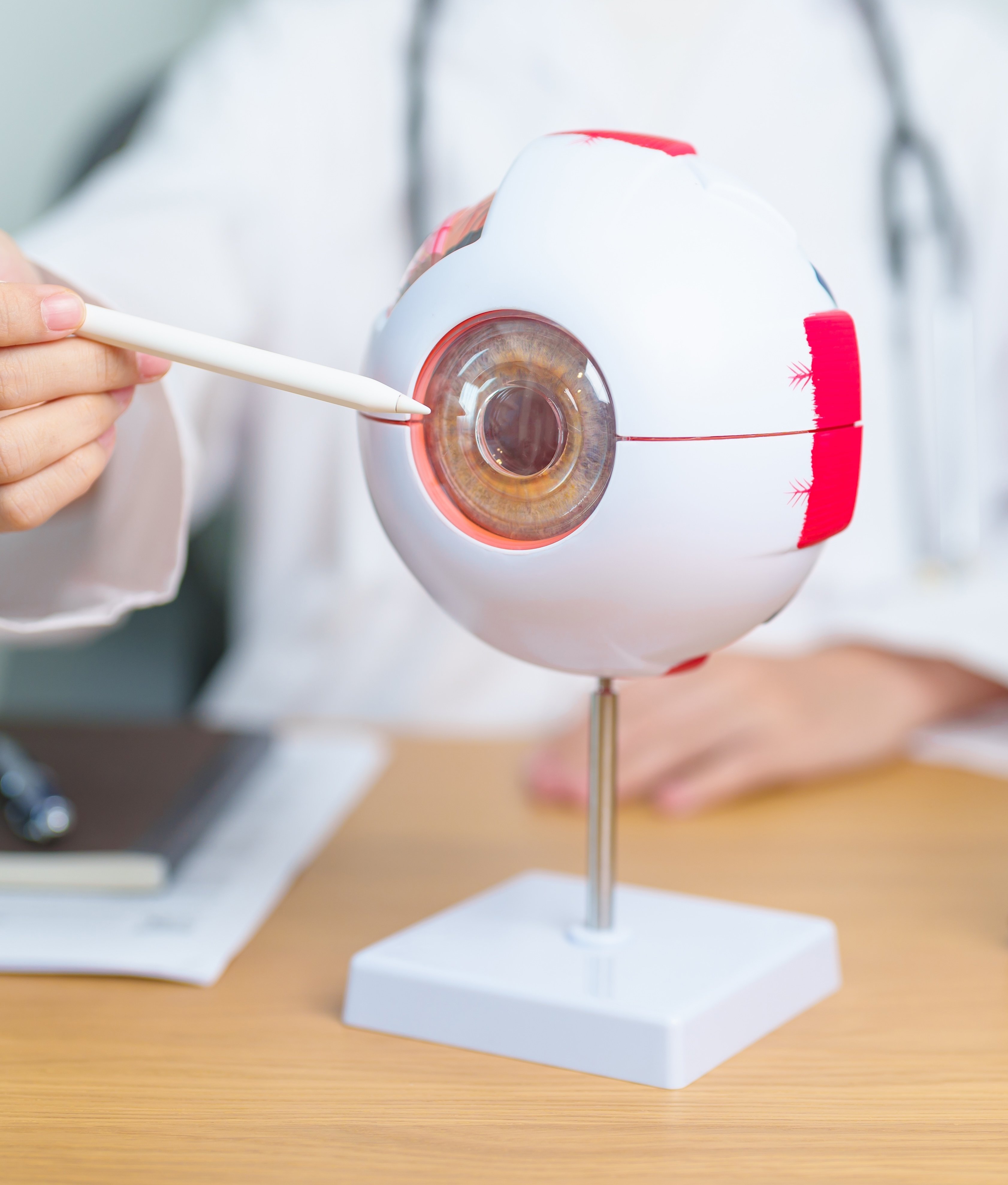 VisionAmerica Gadsden AL eye doctors providing cataract retina cornea and optometry care