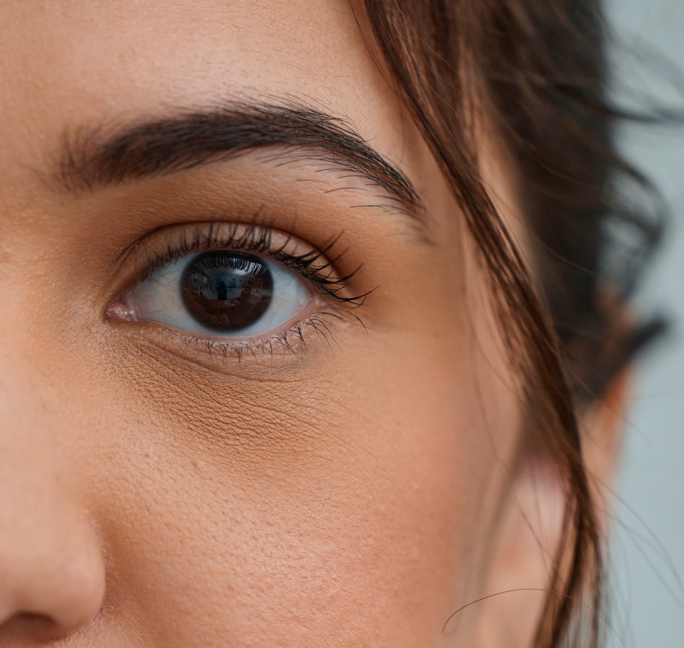 Corneal topography scan showing keratoconus and irregular corneal shape at Southeast Eye Specialists and VisionAmerica