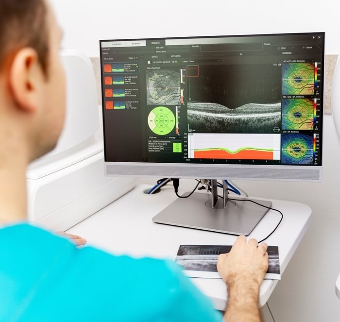 SouthEast Eye Specialists Cleveland TN eye doctors providing cataract glaucoma and retina care