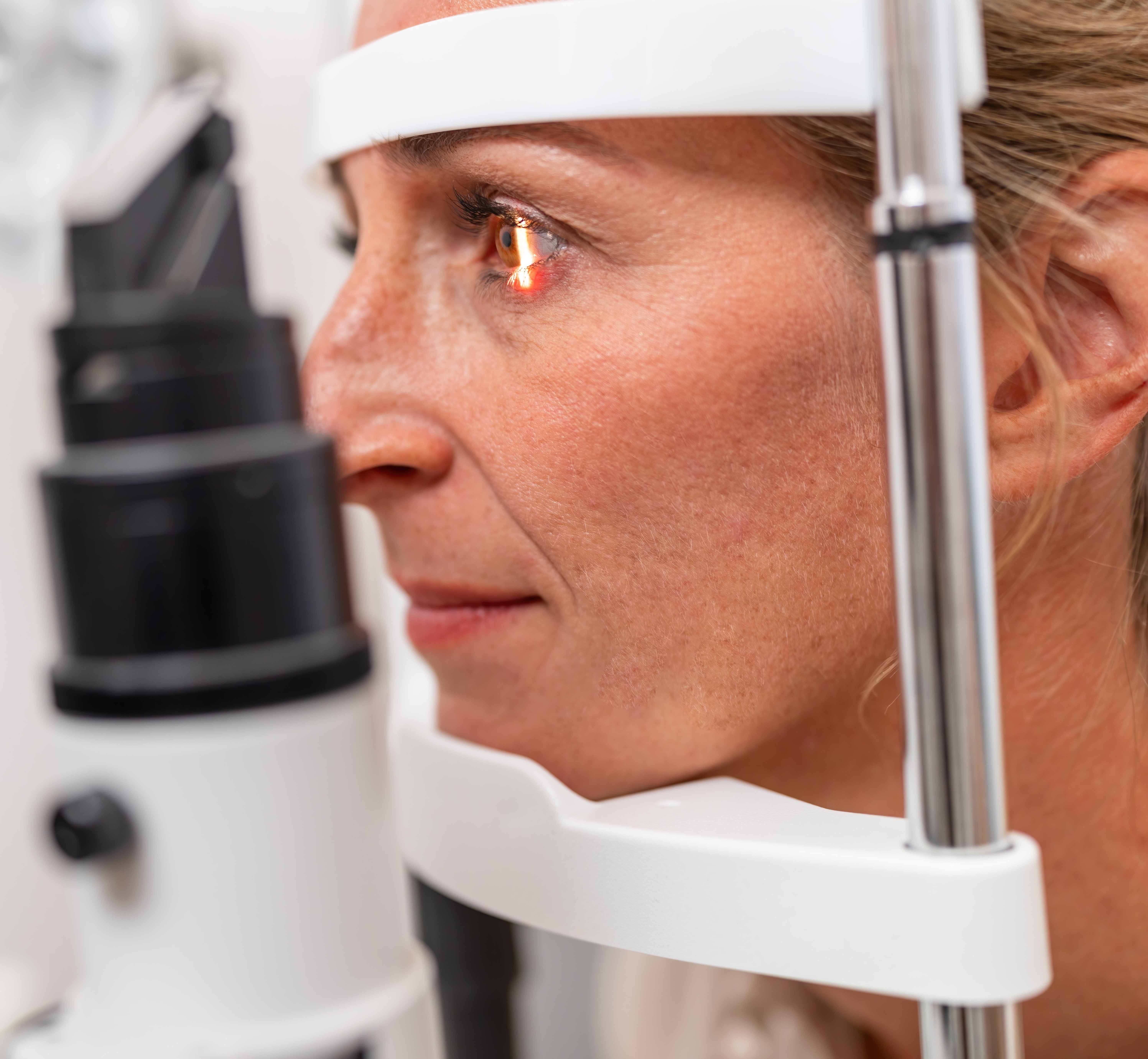 SouthEast Eye Specialists Chattanooga TN eye doctors providing cataract glaucoma retina and cornea care