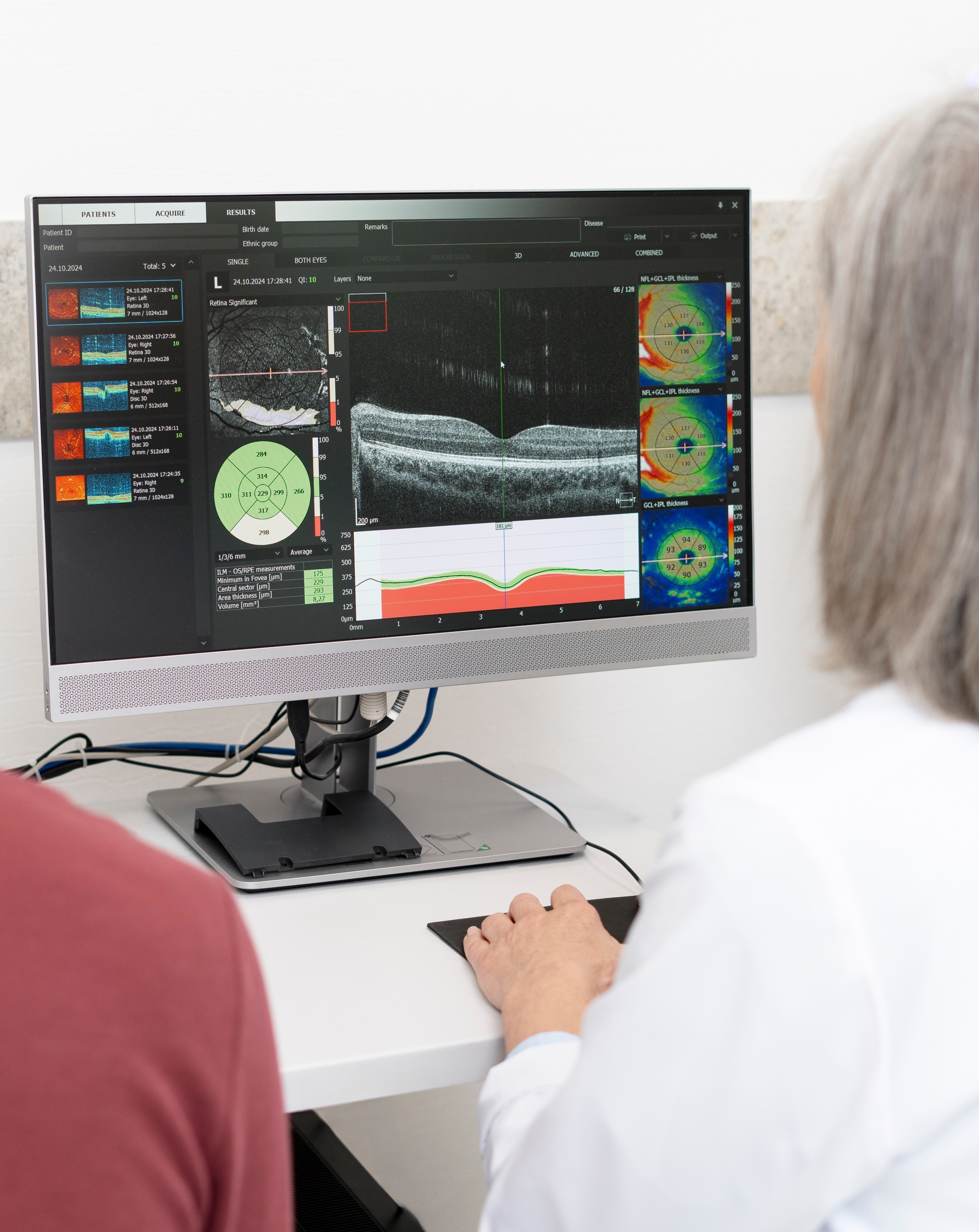 Optical Coherence Tomography (OCT) scan used to detect glaucoma and optic nerve damage